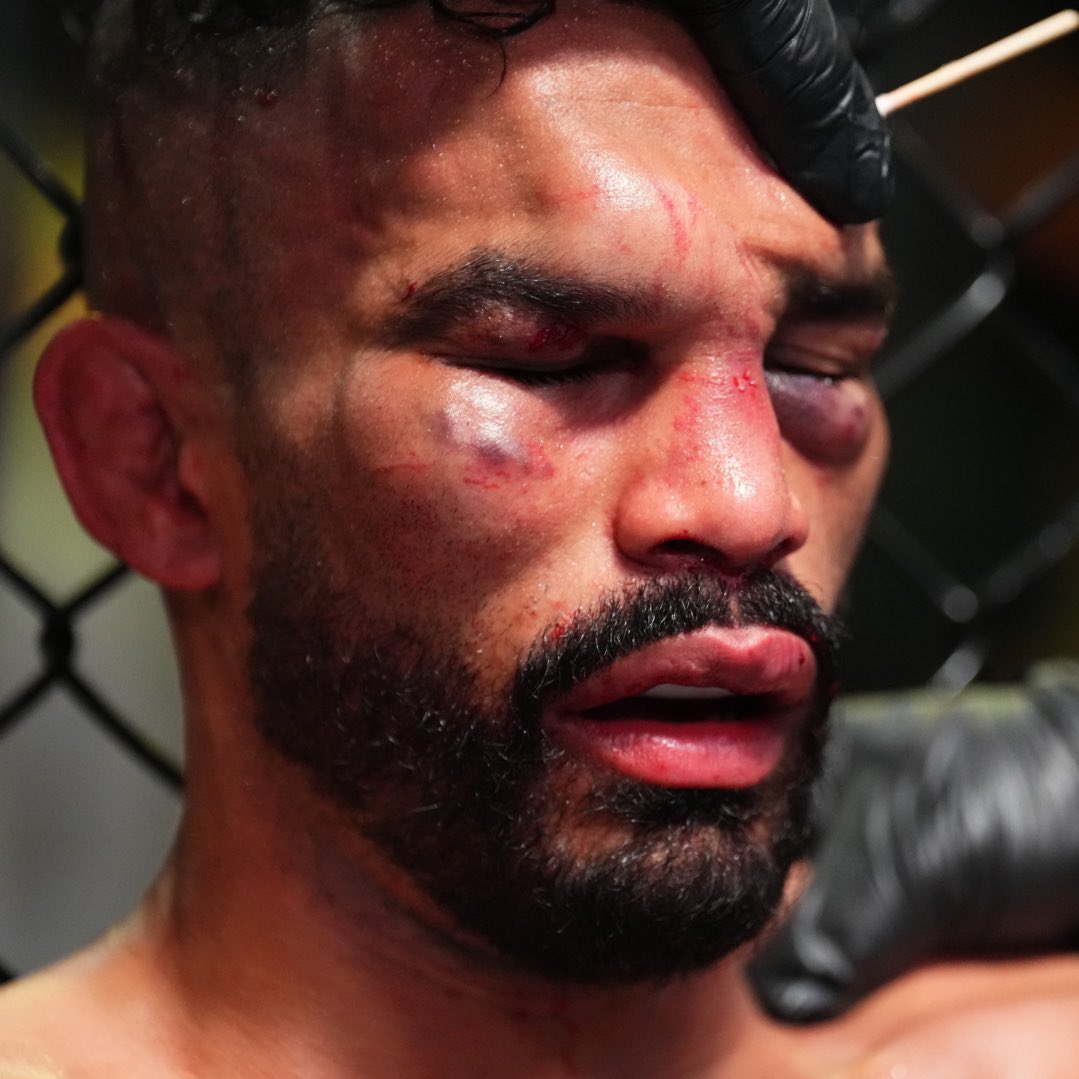 ImAntoMMA's tweet photo. What Chito does to mfs is straight out of Mortal Kombat https://t.co/XU43mxh2PJ
