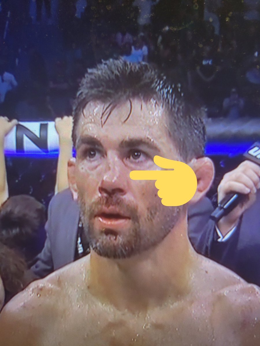 RT @SpinninBackfist: Dominick Cruz nose is very much broken #UFCSanDiego https://t.co/Y3SVduYHN4