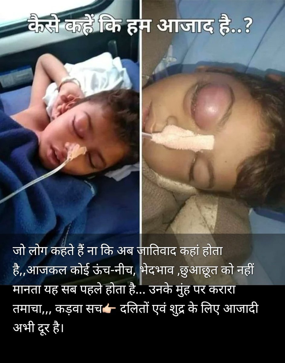 SoniyaJoya's tweet photo. @RajCMO जी आप दलित हितैषी के नाम पर हमे कबतक बेवकूफ बनाते रहोगे?
आपके 3बार मुख्यमंत्री बनने के बाद भी राजस्थान के यह हालत है आखिरक्यो?
 
अब कोई पैसे,मुवावजे की बात नही करना,
मौत के बदले मौत ही होगी तभी ऐसी नि:शब्द घटनाओ पर रोक लगेगी।

ऐसे जातिवादी गुंडो को फांसी ही होनी चाहिए। https://t.co/q59jm6tt2j