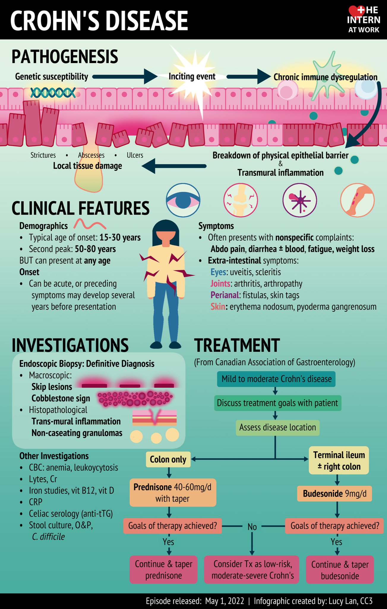 Keith Siau On Twitter Basic Overview Of Crohns Disease Meded