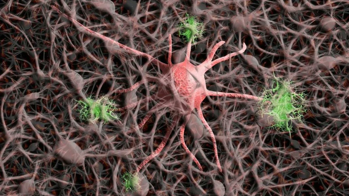 H1Connect's tweet photo. Nerve reinnervation &amp; #pain: Ru-Rong Ji, Marshall Devor &amp; Mark Baron recommend this impressive paper by Gangadharan V et al. @UniHeidelberg published in @Nature that provides new mechanistic insight into chronic #NeuropathicPain.
https://t.co/gt3udzwq6a https://t.co/8UkjbciVNl