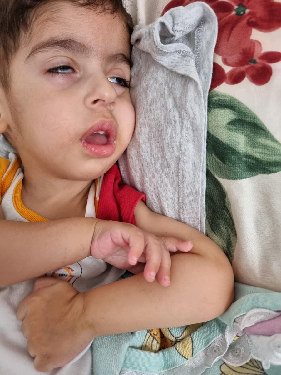 smatip1Muhammed's tweet photo. Mutlu pazarlar🥰
Ben artık gözlerim açık uyuyorum.
Bu sinsi hastalık çok hızlı,göz kaslarıma kadar geldi😔
Siz olmadan bu hastalıkla savaşamam.
Küçücük bir bağış,benden birkaç kişiye bahsetmeniz benim hayatımı kurtaracak🙏

#ÇınaraUmutOl #deprem #shiba #izmir #GenelAf #Ankaragücü https://t.co/0aR61nMi3Z