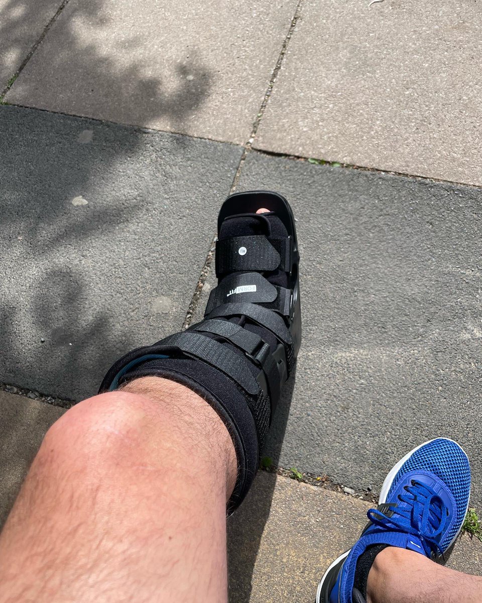 Z10Cricket's tweet photo. After a few weeks of inactivity, I’m back up and running and available for mid season repairs and refurbs #cricket #cricketbat #refurbs #knackeredankle #stemcelldonation https://t.co/4e8F7B0MO9