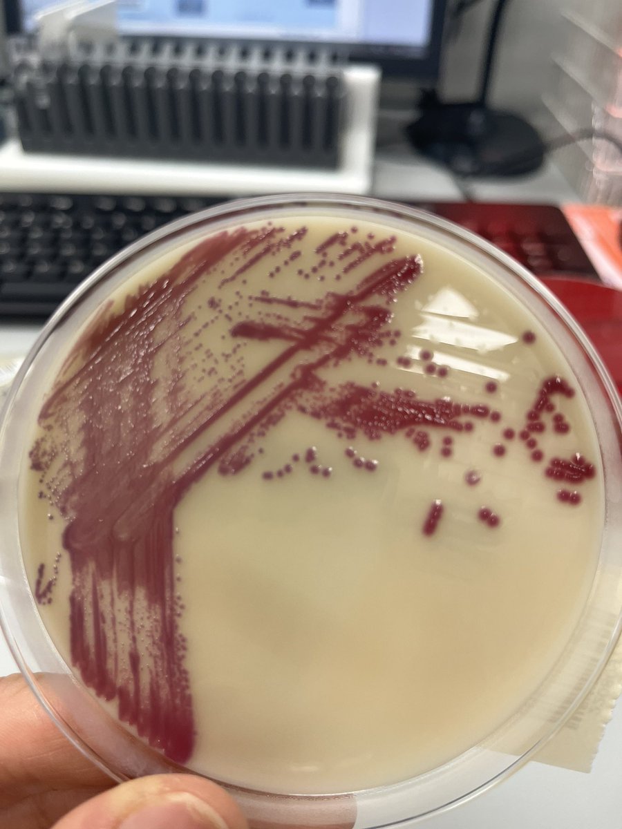abisal1's tweet photo. A little microbiology. A stunning red Serracia marcescens. It doesn’t always grow red on chrome agar but I love when it does. This is what causes the pink scum in your shower and baths. It can also cause infections. But I just admire the beauty!! #SuchAGeek 🤓 https://t.co/7vDPAwo9Ej