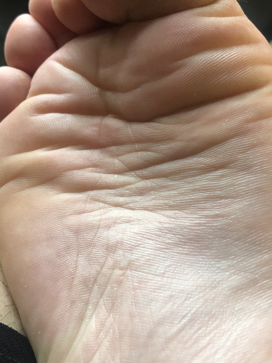 Goddessalex44's tweet photo. Dont you dream of having your tongue in these wrinkles why dont you beg me for it 👯‍♀️👯‍♀️👯‍♀️😈 findom paypig humanatm femdom findomuk feet footfetish footslave https://t.co/lba73BUoOt