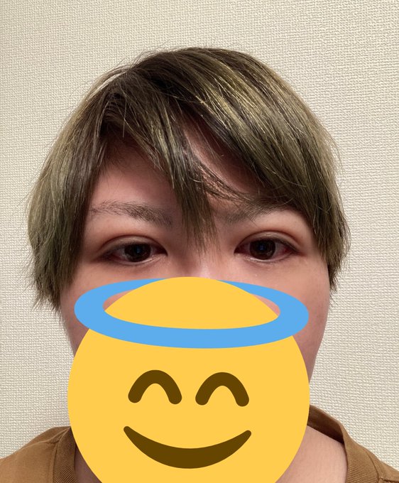 大分腫れがひいてきた虚無顔になってる 