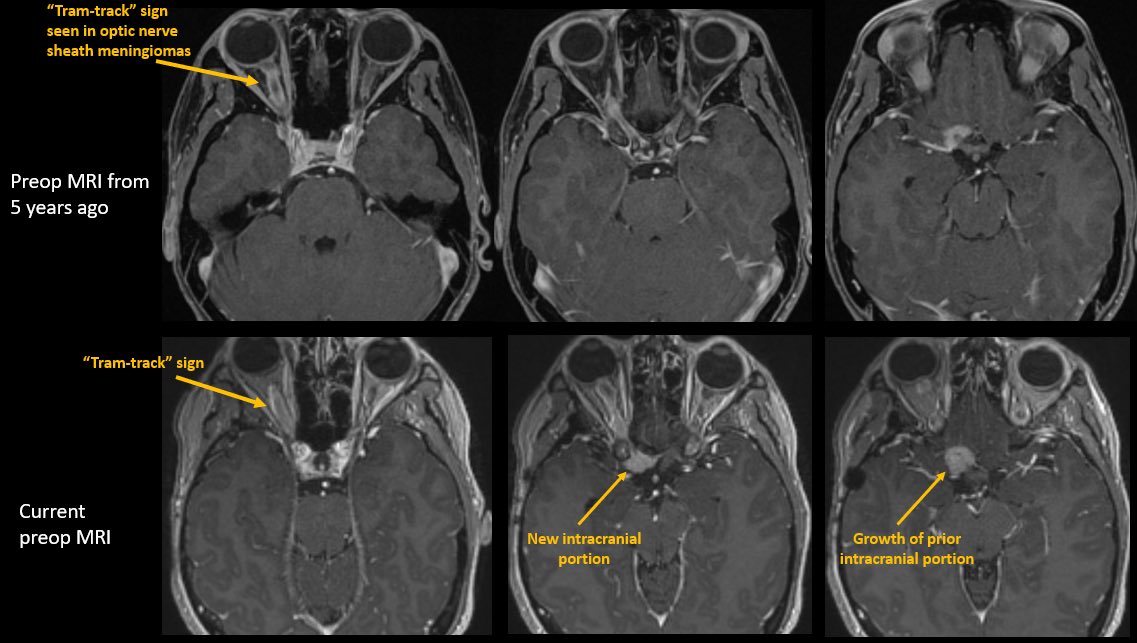 Jacques Morcos MD FRCS FAANS tweet media