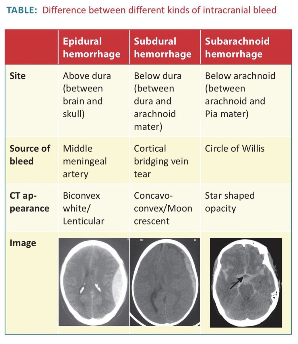 Medical_MD1's tweet photo. Different types of Intracranial Haemorrhage 🧠 

. https://t.co/DZP3SZdBB7