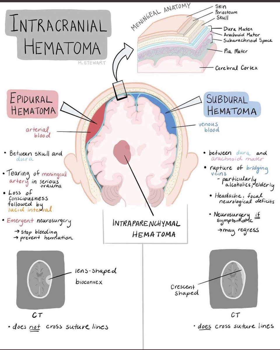 Medical_MD1's tweet photo. Different types of Intracranial Haemorrhage 🧠 

. https://t.co/DZP3SZdBB7