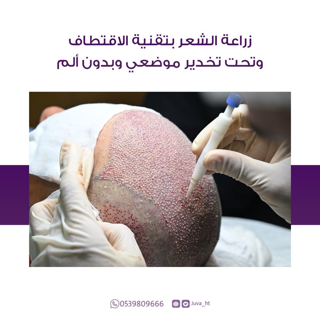 Juva_ht's tweet photo. للإستفسار يُرجى التواصل معنا عبر أرقام الإتصال أو عبر الواتس أب 🌺

📍الرياض ، شارع التخصصي
0114809666 أو 0539809666

#الرياض #زراعة_الشعر_في_تركيا #زراعة #زراعةالشعر #زراعة_الشعر_في_اسطنبول #زراعة_الشعر https://t.co/pMk4OuB1yn