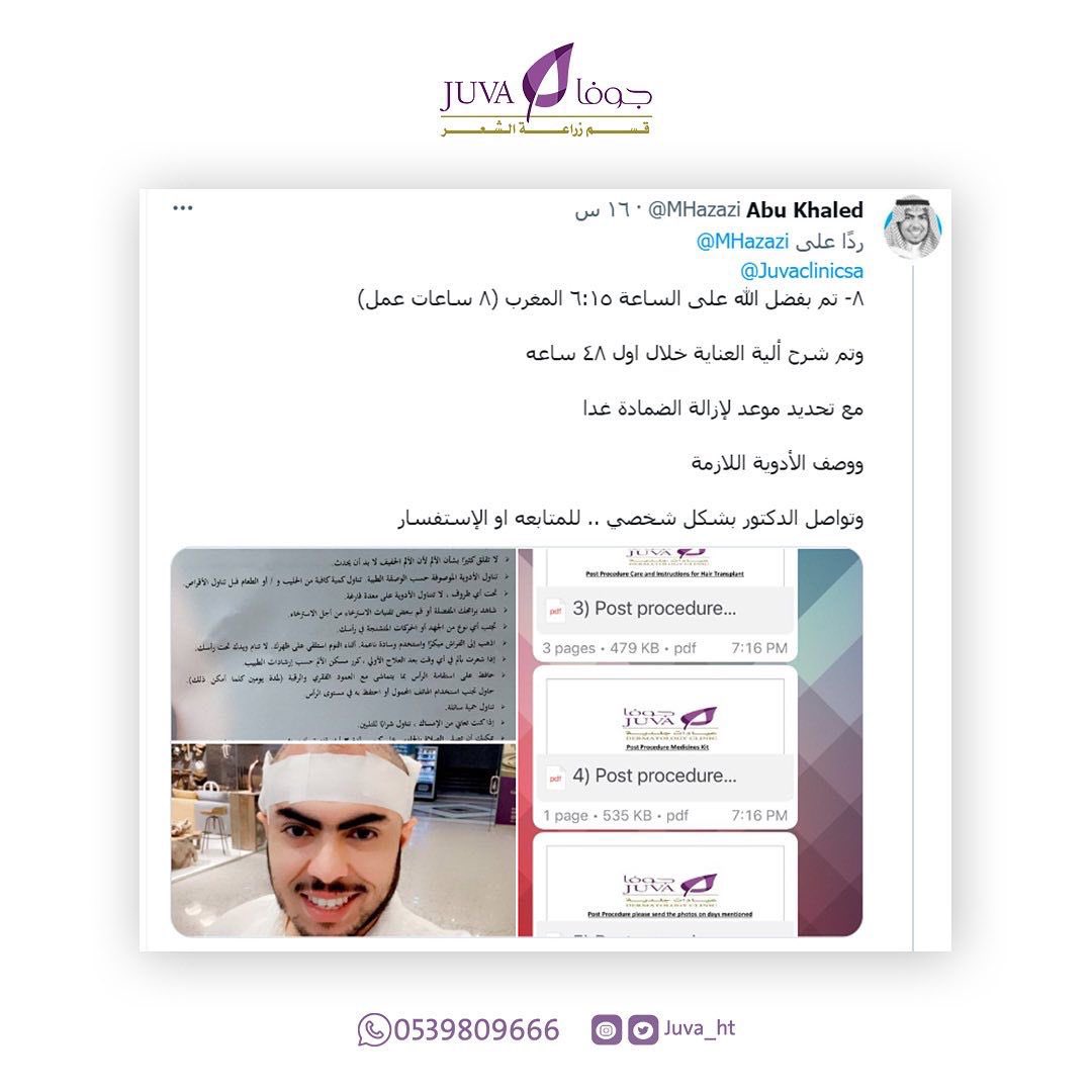 Juva_ht's tweet photo. للإستفسار يُرجى التواصل معنا عبر أرقام الإتصال أو عبر الواتس أب 🌺

📍الرياض ، شارع التخصصي
0114809666 أو 0539809666

#الرياض #زراعة_الشعر_في_تركيا #زراعة #زراعةالشعر #زراعة_الشعر_في_اسطنبول #زراعة_الشعر https://t.co/e4ctH1PVtR