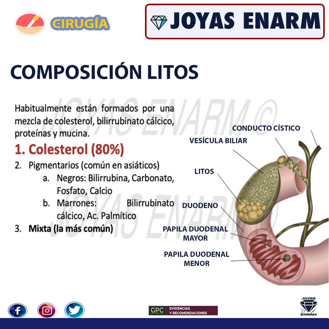 Joyas_ENARM's tweet photo. 💎Colecistitis Parte 1💎

✅ Encuentra el tema completo en la plataforma de Joyas ENARM.
🏆 https://t.co/Hs6dz9jCVK 

🚨 ¡Último repaso previo al ENARM! 
#ENARM #ENARM2022 https://t.co/gg2Z0TK2RU