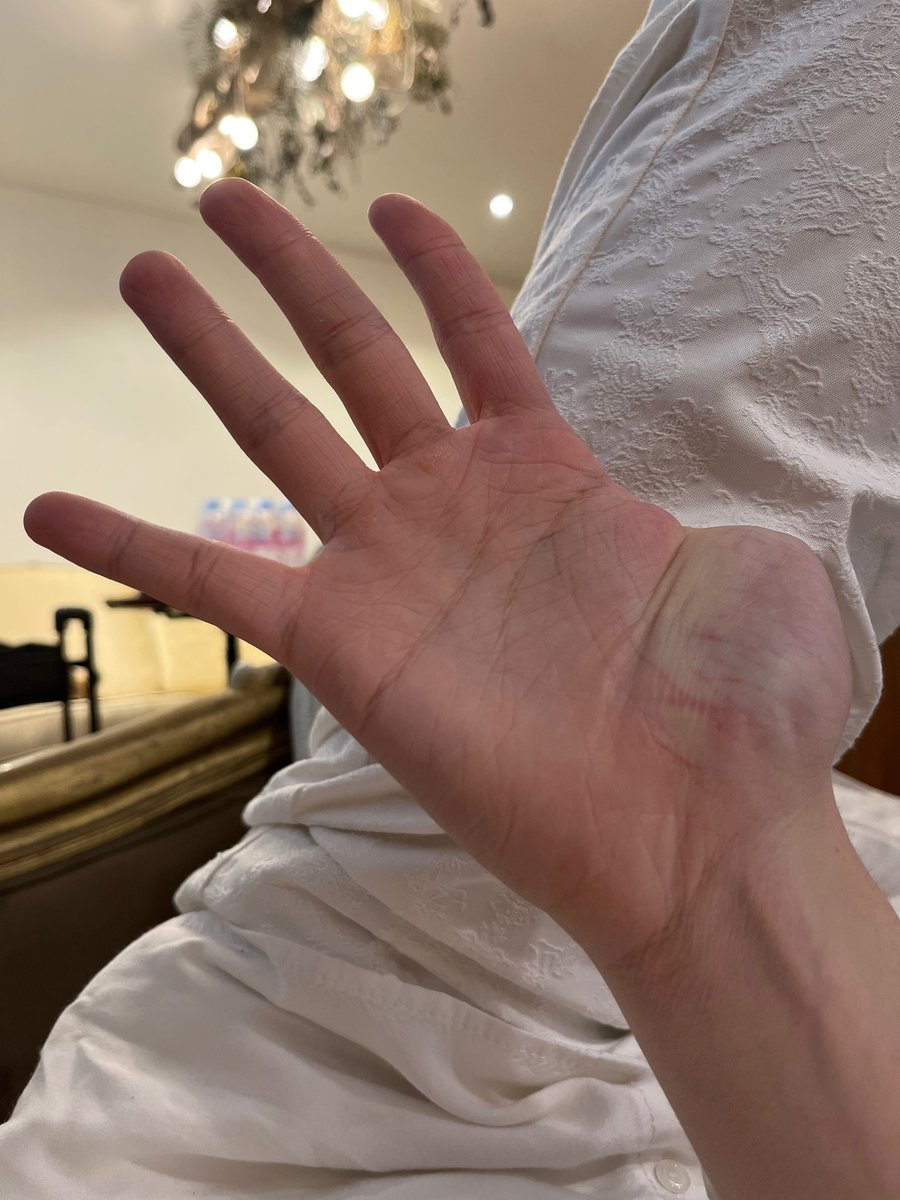 Shienashinxoxo's tweet photo. Wangmori Finger artist challenge all done 🐯🐬🐹☺✔️ #CHENLE #천러버블 #MARK #JISUNG #CHENLEBUBBLE
데 넘 많이 하지 말어 다칠라 🥺 https://t.co/yWueW2CzvS