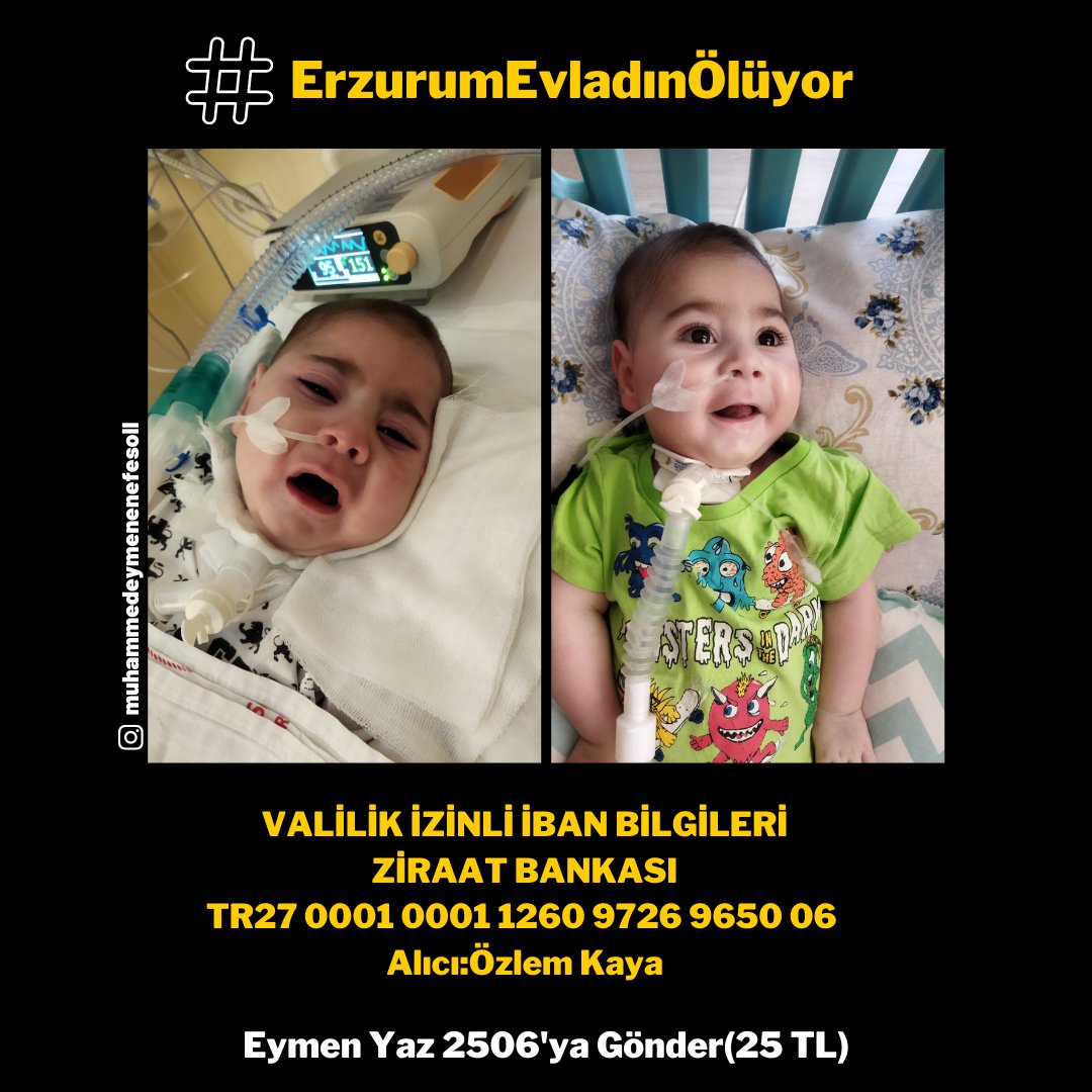 Ykp_Clskn05's tweet photo. Sma hastası
MUHAMMED EYMEN'e

Tweetlerimiz ile Ses
 
BAĞIŞ ve SMSlerimiz ile Nefes olalım

#ErzurumEvladınÖlüyor
@eymenenefesol Valilik İzn https://t.co/yuKTWO8ARG