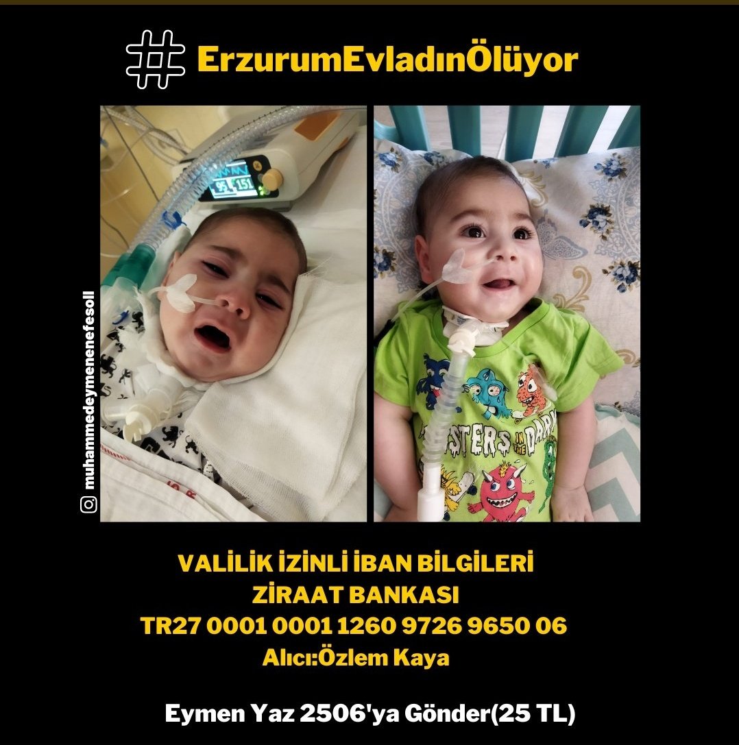Dominant0_0's tweet photo. #ErzurumEvladınÖlüyor
Muhammed Eymene nefes olalım. https://t.co/5U3ev7UmRh