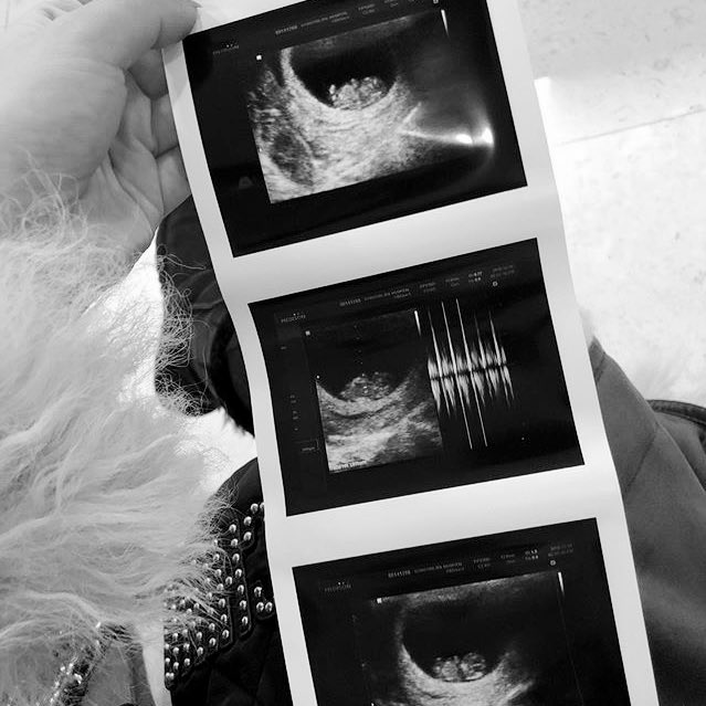 void2chanel's tweet image. happy father’s day !