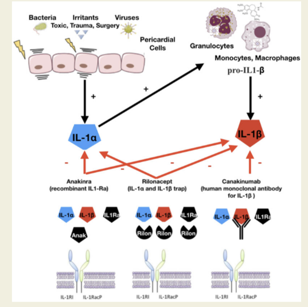 Emanuele Monda (@mondaemanuele) on Twitter photo Anti-interleukin-1 agents for pericarditis: a primer for cardiologists!
<a href="/escardio/">European Society of Cardiology</a> <a href="/ESC_Journals/">European Society of Cardiology Journals</a>
academic.oup.com/eurheartj/arti… Anti-interleukin-1 agents for pericarditis: a primer for cardiologists!
<a href="/escardio/">European Society of Cardiology</a> <a href="/ESC_Journals/">European Society of Cardiology Journals</a>
academic.oup.com/eurheartj/arti…