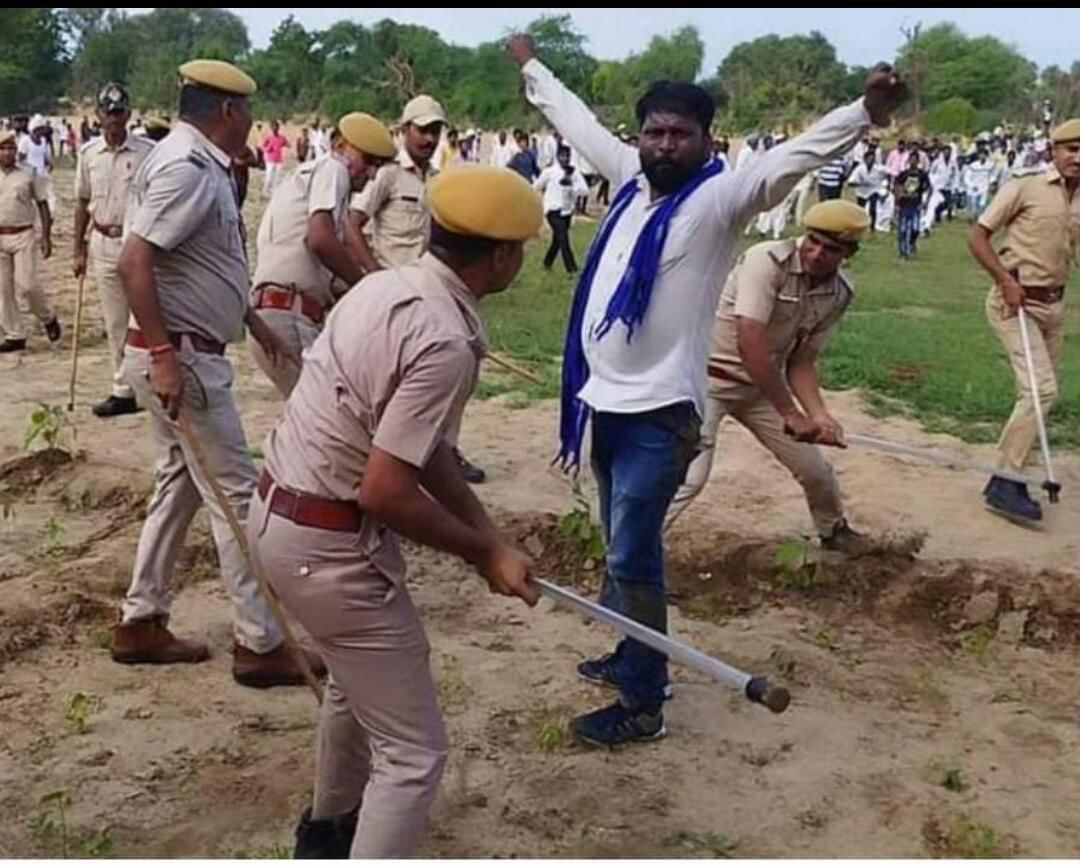 BhimArmy_BEM's tweet photo. दम है कितना दमन मे तेरे।
देख लिया है और देखेंगे। 
भीम आर्मी के सिरोही जिला संगठन मंत्री मोतीलाल हीरागर जी आज मृतक इंद्र कुमार को न्याय दिलाने गए थे। अशोक गहलोत जी कि पुलिस ने लाठियों से पीट पीट कर उनकी टांग तोड़ दी। बहादुर भाई मोतीलाल जी को जय भीम। https://t.co/Lgw5MKSPjp