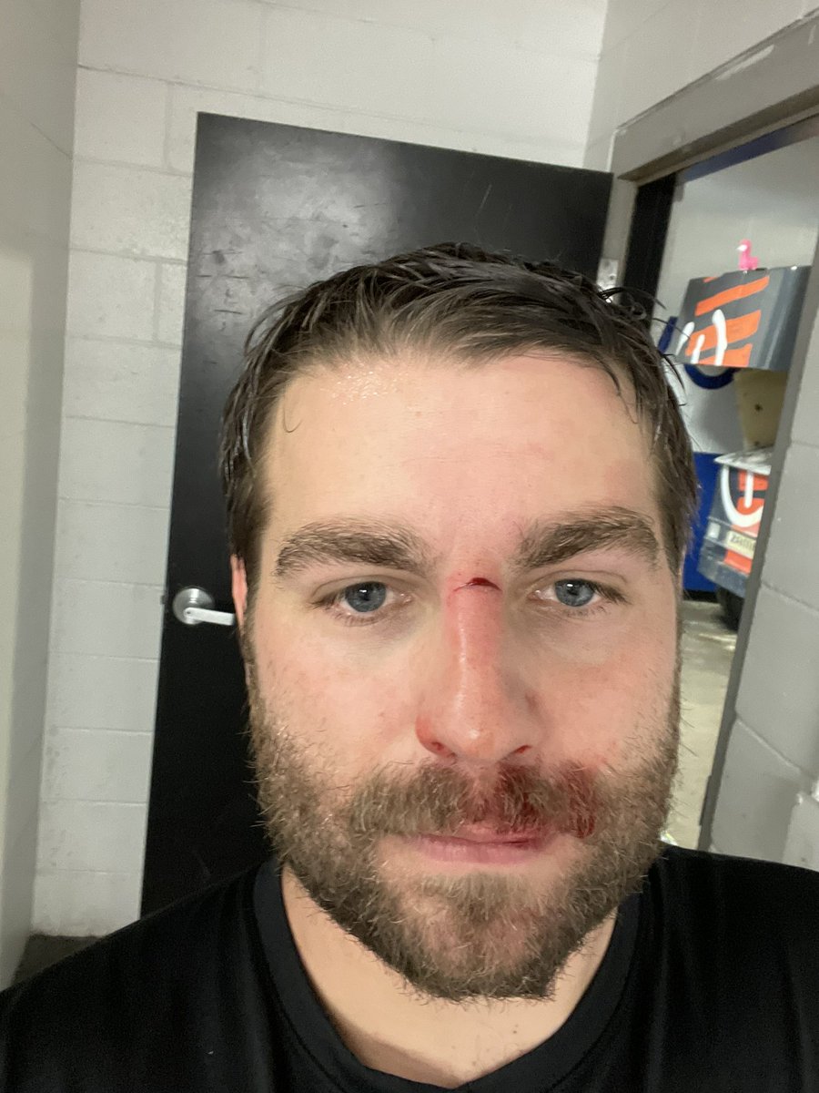 Box lacrosse is fun. Coming home banged up after a split series with Omaha. #GPBLL #MOMastodons