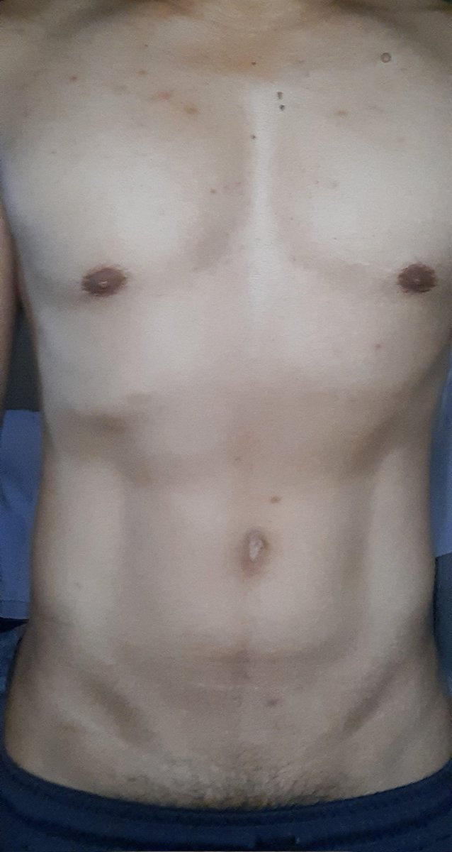 lloydie57's tweet photo. Need more discipline...
More determination
Medjo may taba pa ng konti..
#PROUD46💪😊 https://t.co/vaRP1BDPFr
