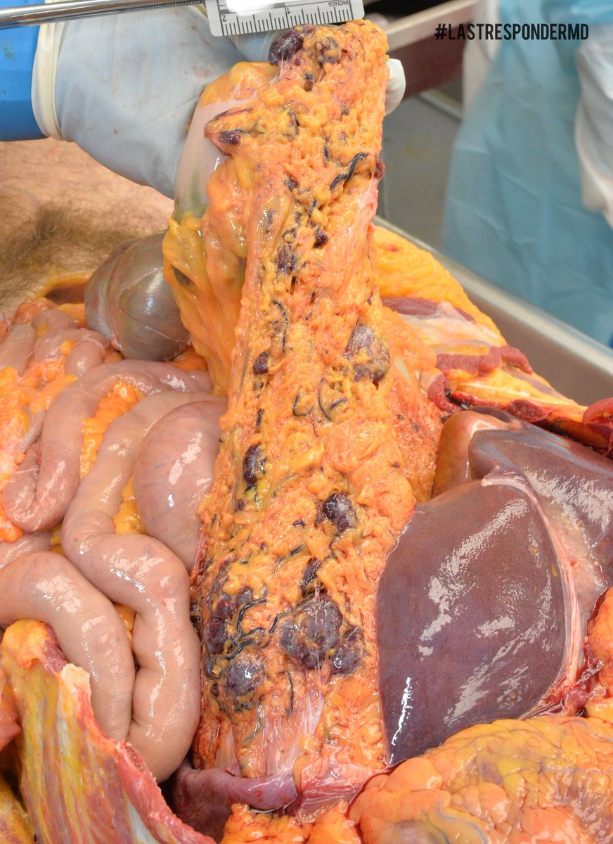 LastResponderMD tweet media