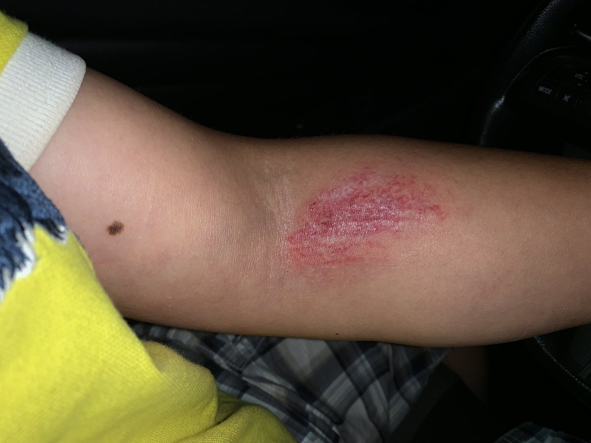 iamcez_'s tweet photo. My little brother was on one of the kids rides and when the commotion started the operator stopped the ride and ran away, my dad fell jumping over the line dividers to go get my brother out of the seat. I’m glad It was just a scratch. Pray for the victims tonight. https://t.co/cNt4e0SgHl