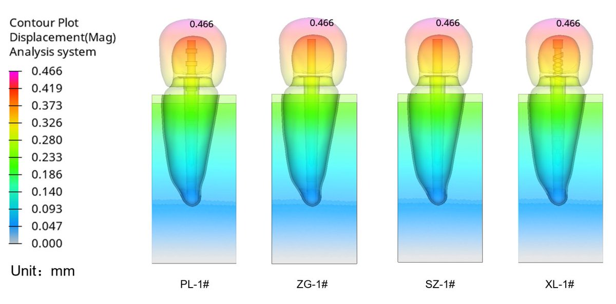 Aria112244's tweet image. The fiber post process gives it maximum stress and anti-fracture strength under normal occlusion conditions.
Use longer
Fewer fractures 
Lower return rate
#fiberpost #dentalsupplies #dentalcare #dental #postcorecrown
📱+86 18948987800