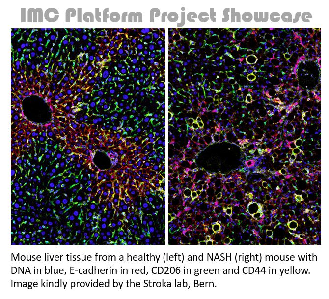We're proud to present our next IMC Platform showcase user project from <a href="/unibern/">Universität Bern</a> <a href="/VSRL_Bern/">Visceral Surgery Research Bern</a> <a href="/FabienneBirrer/">Fabienne Birrer</a>