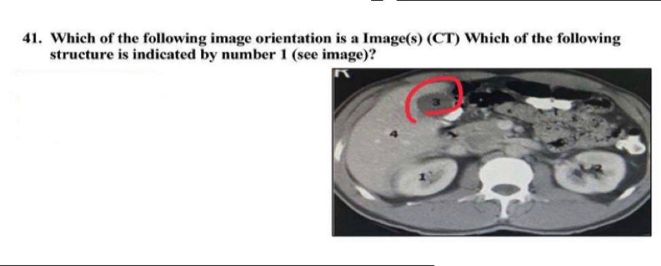 u8bu_'s tweet photo. #abdomen #CT #computed_tomography #الأشعة_المقطعية https://t.co/sHKWRrAXIW