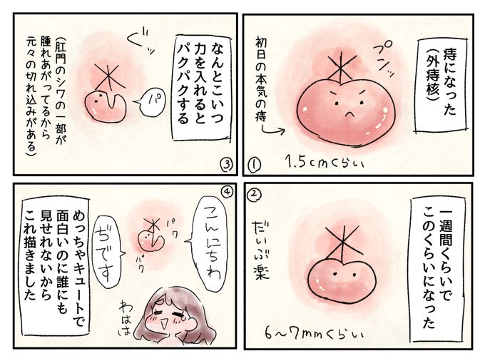 人生二度目の座れないレベルの痔になったんですが結構可愛いです 