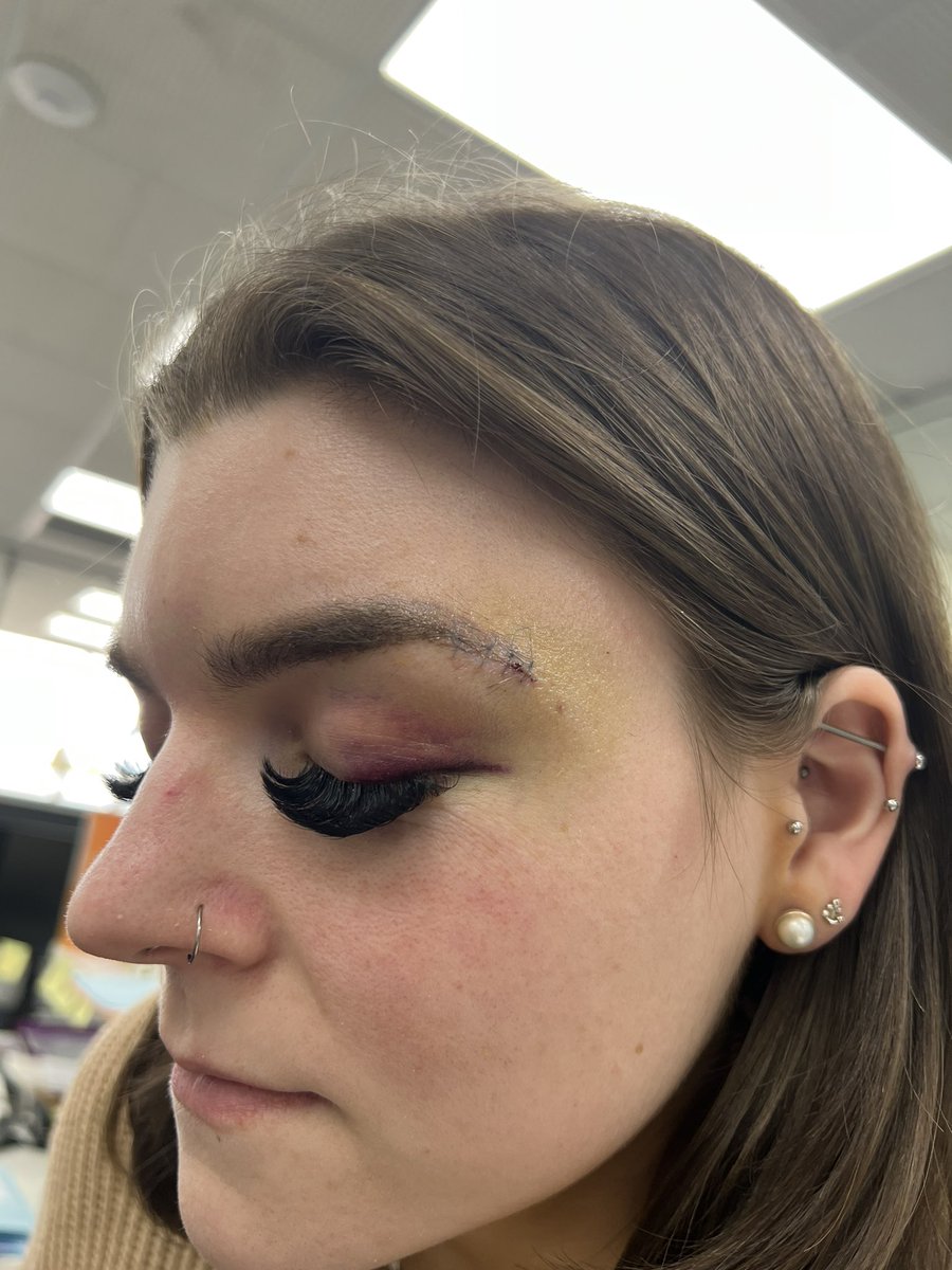 taynalfisting's tweet photo. Update on my eye she bruisinnng https://t.co/TLF9T21RvQ