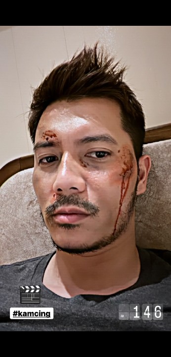 FazuraMinaz's tweet photo. Dah kenapa muka Fattah Amin camni?

#kamcing https://t.co/MQTCqCPN1T