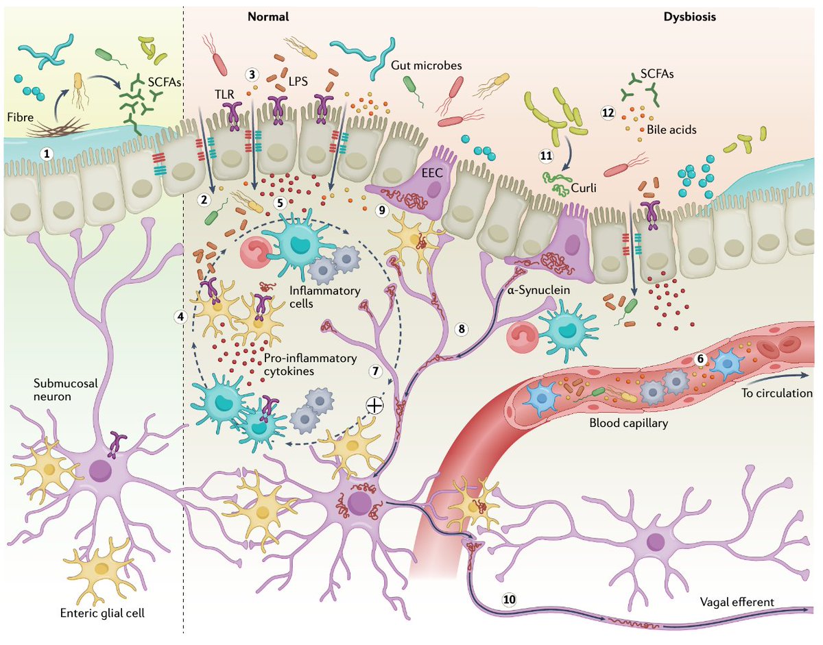 Evidence is mounting that the gut-microbiota-brain axis is relevant for Parkinson's disease progression. This review in <a href="/NatRevNeurol/">Nat Rev Neurology</a> updates what we know so far on gut microbes on Parkinson's disease and summarize trials exploring the role of diet ow.ly/C6xn30spxOo