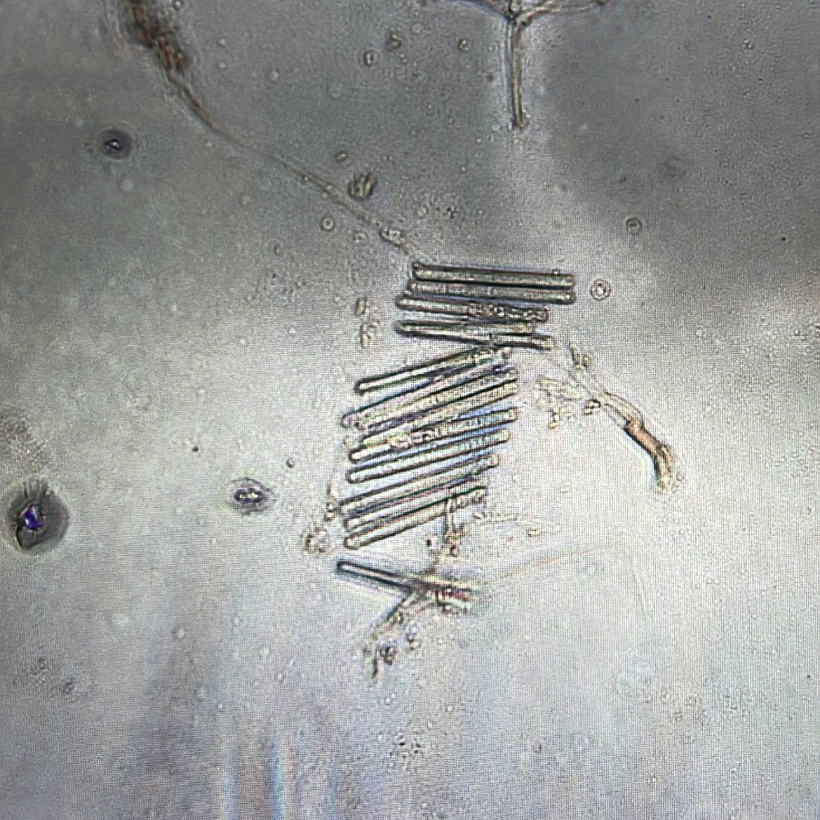 PlantDocEllie's tweet photo. #Calonectria on pitcher plants. Lovey rod-shaped spores 🍄 🔬 #pitcherplants #sarracenia #carnivorousplants https://t.co/VUasIpvawH