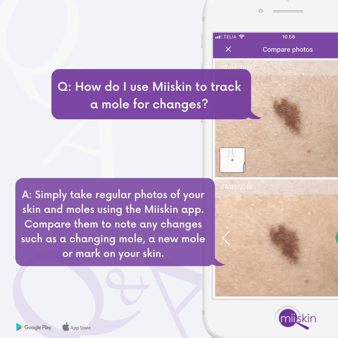 Online dermatologists and prescriptions | Miiskin tweet media