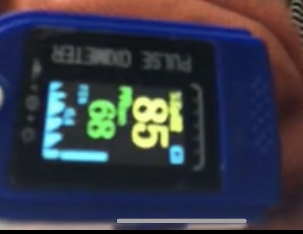 SabinehazanMD's tweet image. L’observation clinique est tres importante. Voila les examples. Clinical observations are very important. Here are  examples.