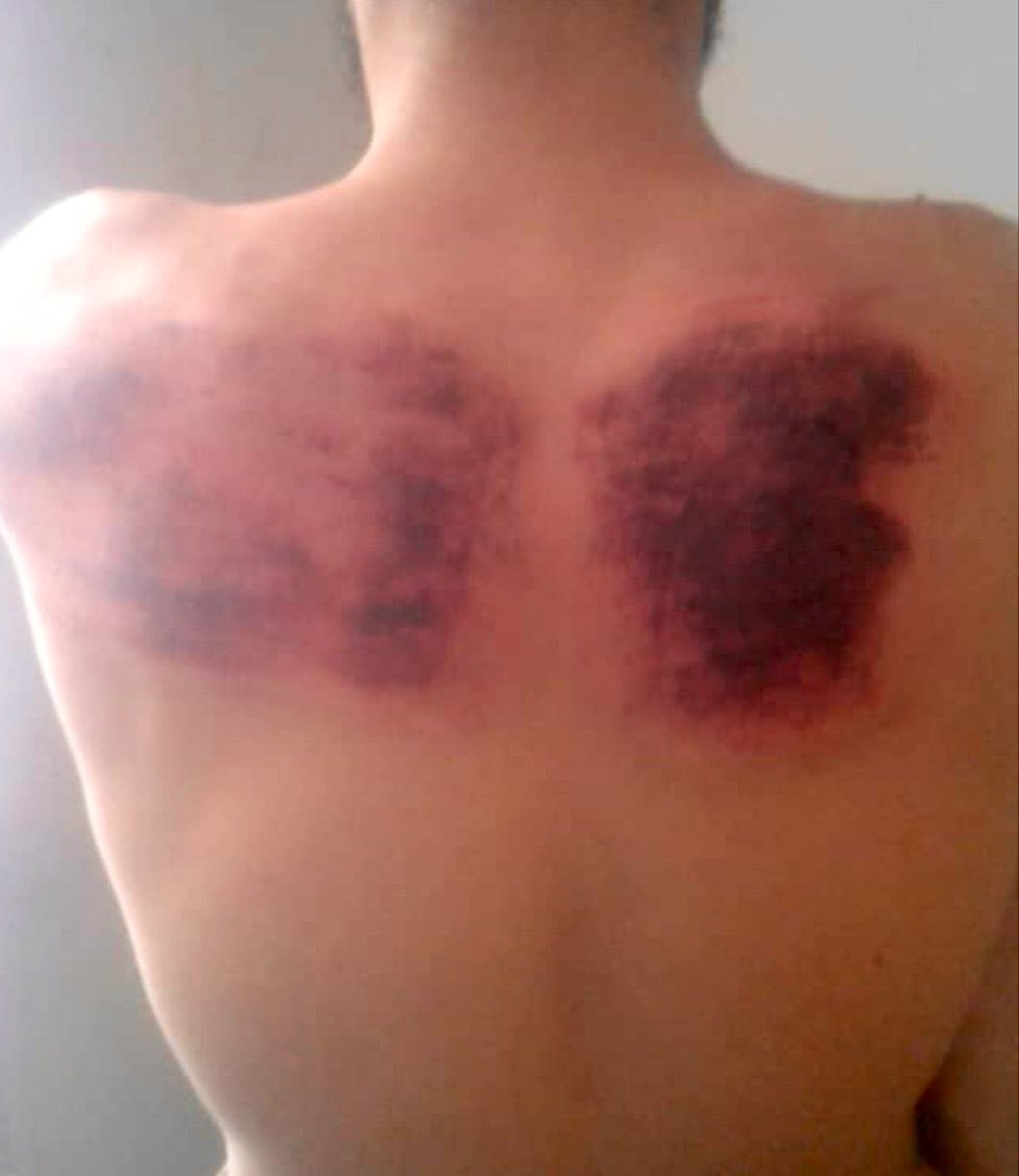 mortazabehboudi's tweet photo. C’est ça la vie des journalistes afghans qui couvrent une manifestation des femmes à Kaboul. Samedi, les talibans ont arrêté ce journaliste local. Au commissariat, il a été fouetté, a reçu des coups de pied, puis des décharges électriques. Voilà un an des talibans. #Afghanistan https://t.co/av6zK5Ob66