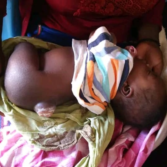 manlikearticle's tweet image. Here is my little siblings who's in need of help ... He really need a help at this moment.,😭😭😭