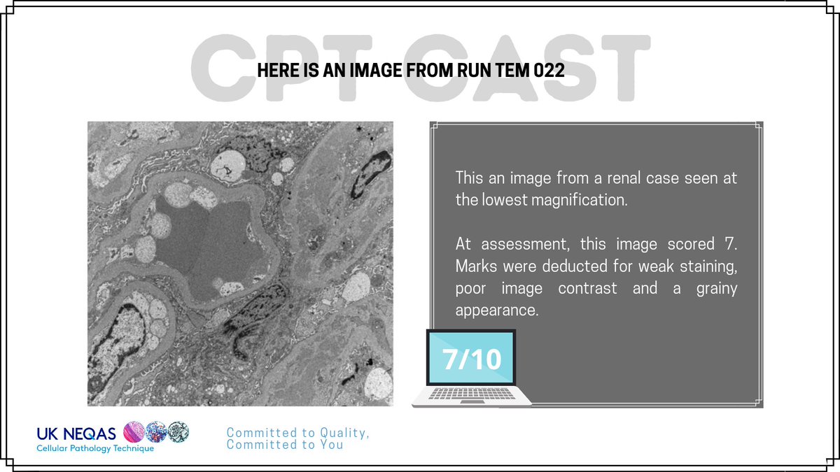 ukneqascpt's tweet image. This slide from the TEM scheme scored a 7/10 at assessment. Do you agree? 🤔
#cptcast #ukneqastemscheme #ukneqascptassessment #cellularpathology