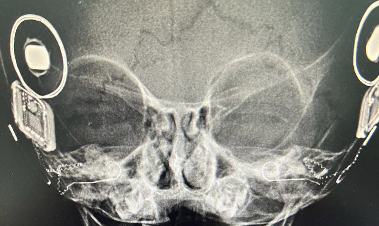 د:سعد العنزي tweet media