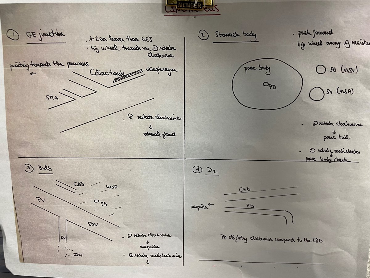 Therapeutic endoscopy dramatically changed with the addition of echoendosonography 🔥

First radial echoendoscope was designed by <a href="/Olympus_Corp/">Olympus</a> and utilized in Tokyo in 1982

We all ❤️EUS, so let's talk about 4 stations to help guide with anatomy #GITwitter #MedTwitter #MedEd