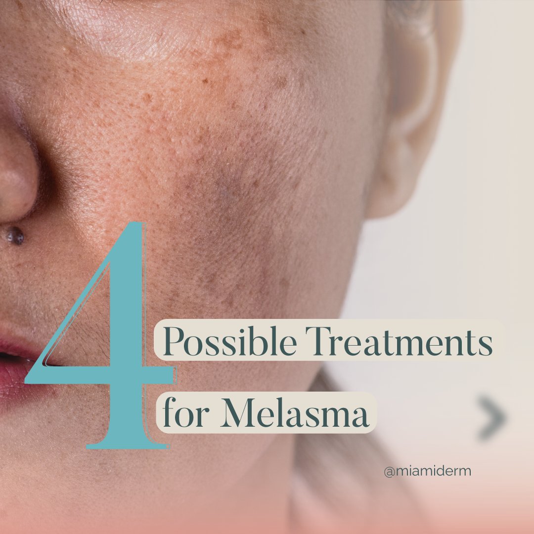 DrMiamiDerm's tweet photo. When dealing with melasma it is important to know that there is no one best treatment.
#melasmatratamento #melasmasolution #melasmacream #melasmaresistente #melasmatreatment #melasma #skinhealth #skincare #skintips #miamidermatologa #dermatologistonlineconsultation https://t.co/WD9TLpDwWU
