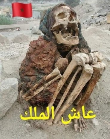 AnalyzerMed's tweet photo. @HananeRebelle @ZeghilecheA كثر ذباب المخزن عندنا https://t.co/XuQVOo4VaW