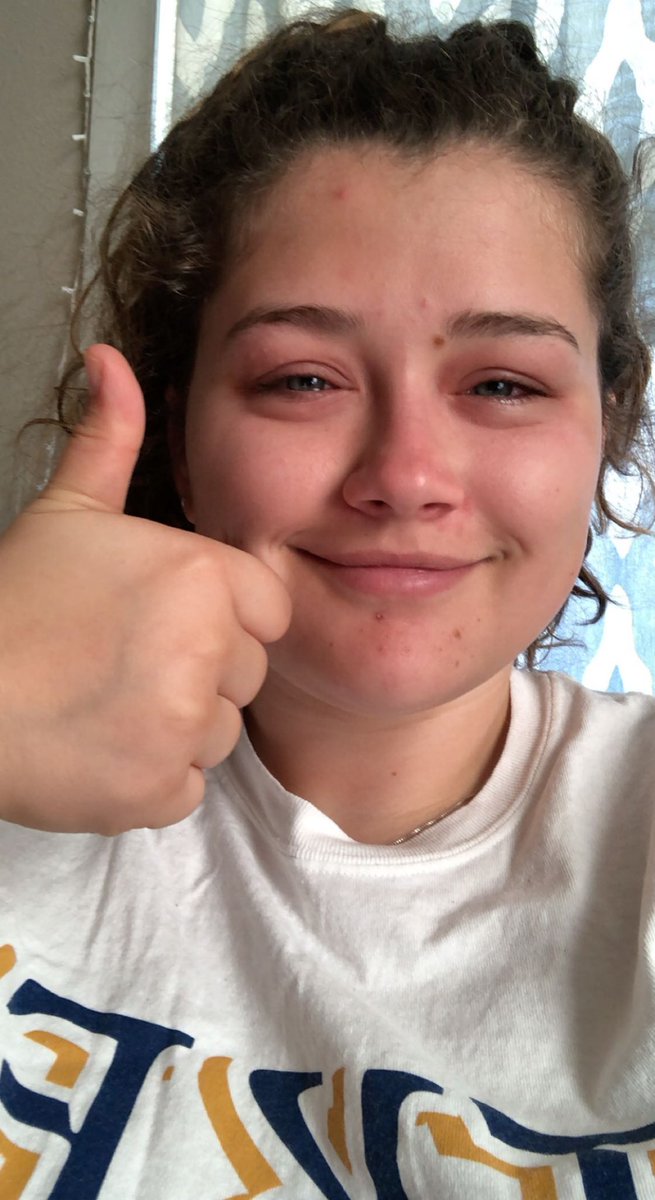 madisonslamb's tweet photo. 3 years ago today, I discovered I am allergic to peaches https://t.co/H2jOgQO1KN