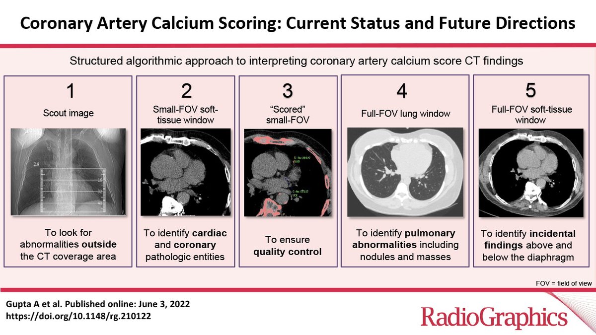 RadioGraphics's tweet photo. Calcium score is an indespensible tool for stratifying cardiovascular risk, predicting patient outcomes, and guiding preventive therapy. This article focuses on scan protocol, methods of calculating a score, and MESA percentile scores. https://t.co/s5idANQGwV https://t.co/iDfPAcUK4E