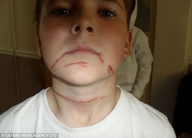bagguley's tweet photo. @Cornpop_BadDude @FrizzellH @SpaceGator420 Yep. A rope across the neck is nasty. Even if there was only a 1% chance, that's still too much. This is what it can do. Would you be happy for your child to have this done to them? https://t.co/r9L4Y03YQ3