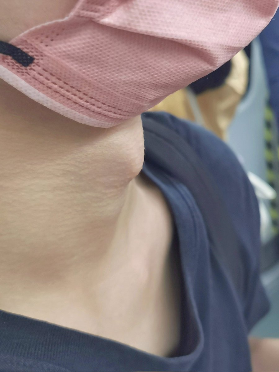SCNU0729's tweet photo. Many university students have protruding Adam's apple, take this guy for example. https://t.co/13aTCGJrWP