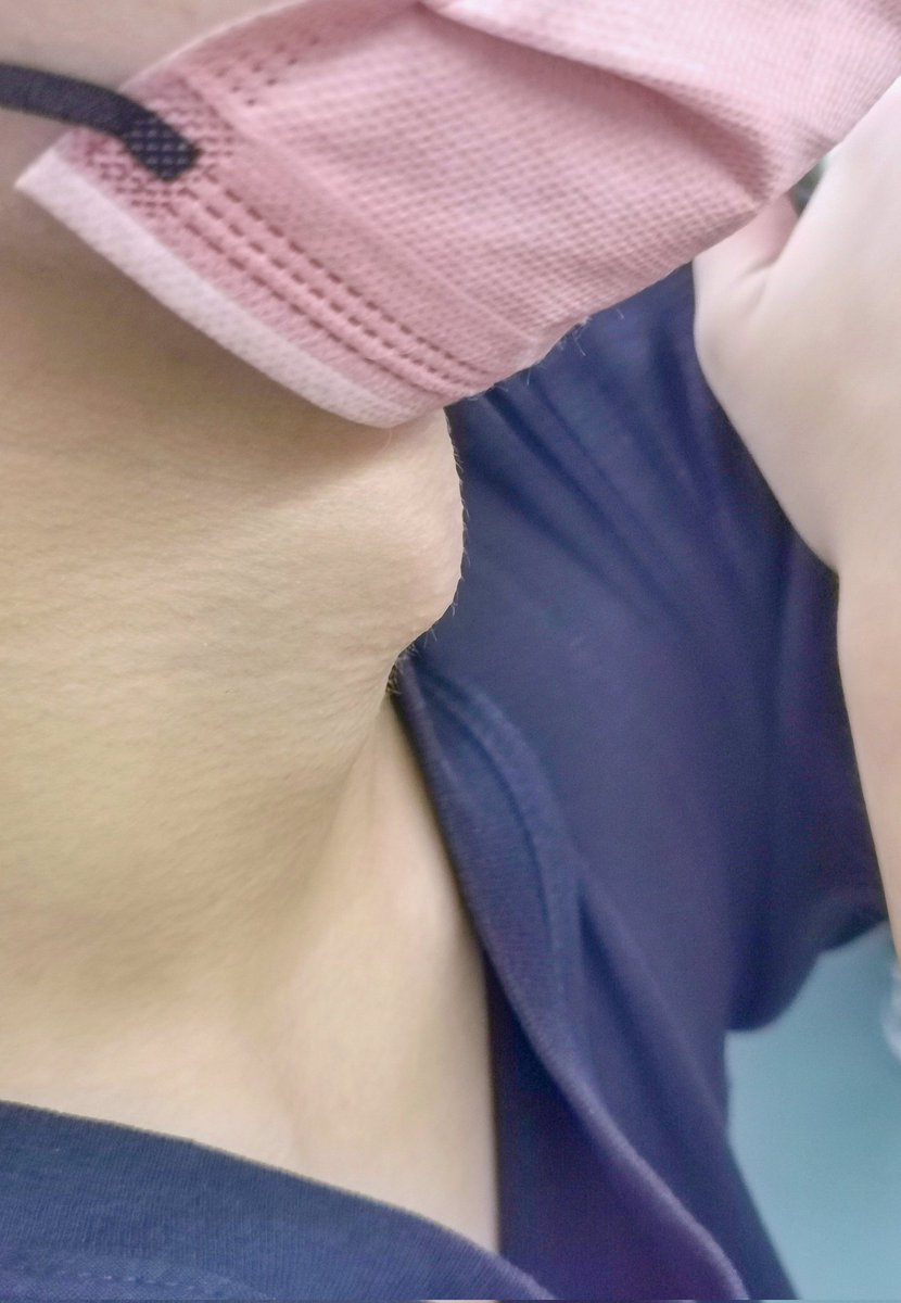 SCNU0729's tweet photo. Many university students have protruding Adam's apple, take this guy for example. https://t.co/13aTCGJrWP