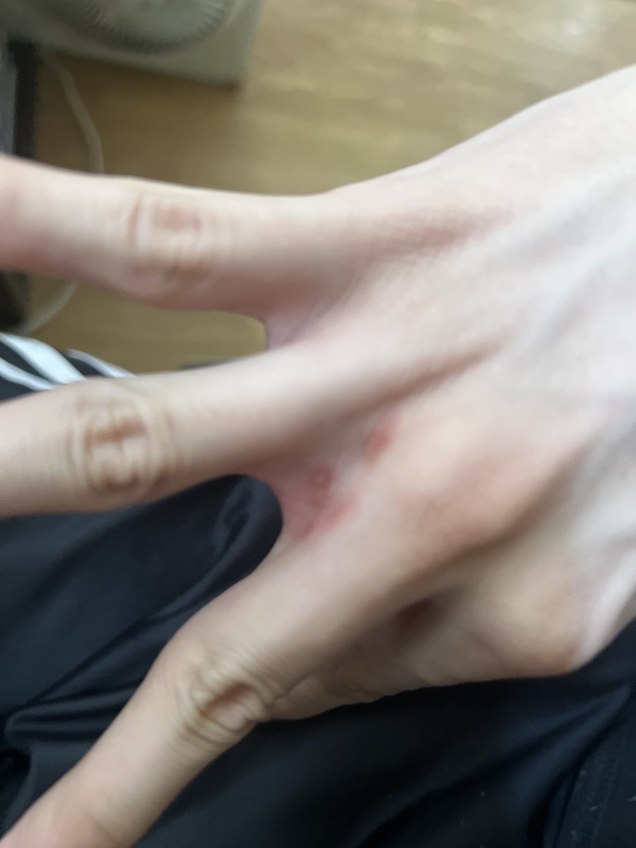 Starting tweet media