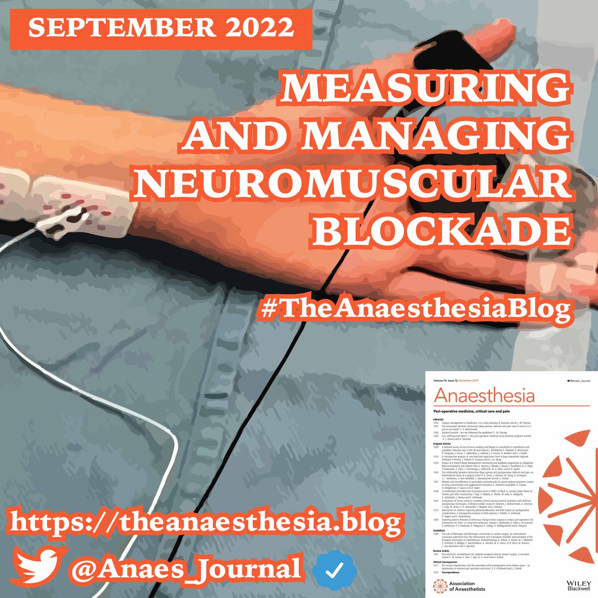 Anaes_Journal's tweet image. 🔐The September issue is now online! Topics this month include...
-facemask ventilation
-neuromuscular blockade
-AGPs
-Maternal morbidity
-Equity, diversity and inclusivity 
-Volatile pollution
-@UniversalAirway and @NAPs_RCoA

#TheAnaesthesiaBlog

🔗theanaesthesia.blog/2022/08/15/mea…